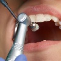 Profilaxia-metodo-RAG